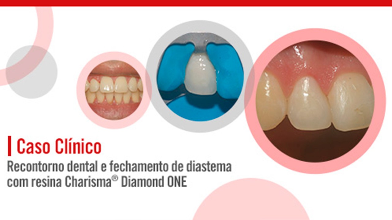 Caso clínico