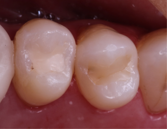 1- Imagem inicial do caso clínico
