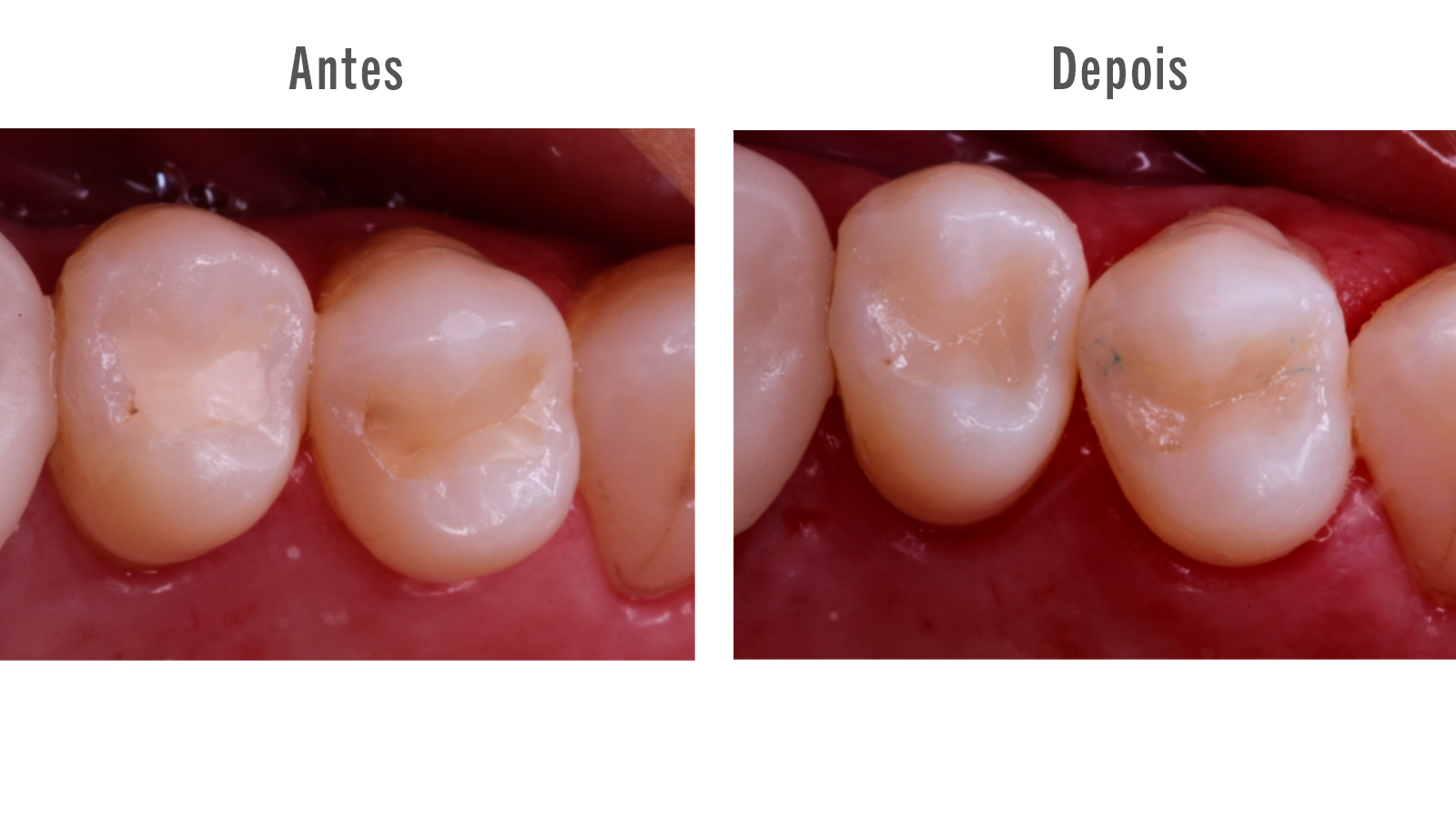 21- Antes e Depois