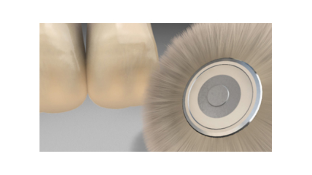 Acessórios para resinas compostas indiretas