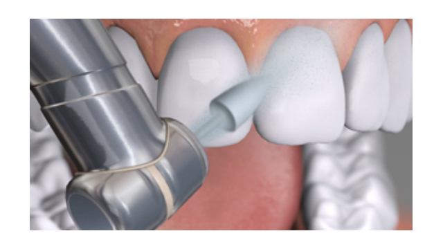 Materiais Restauradores