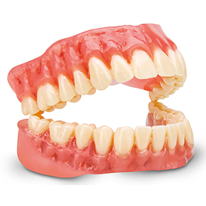 dima print digital denture