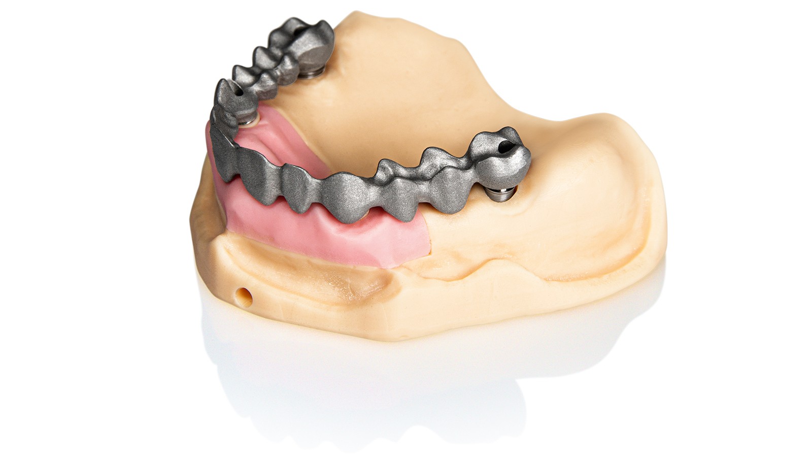 Modelos de Implante 3D com dima Print Gingiva Mask