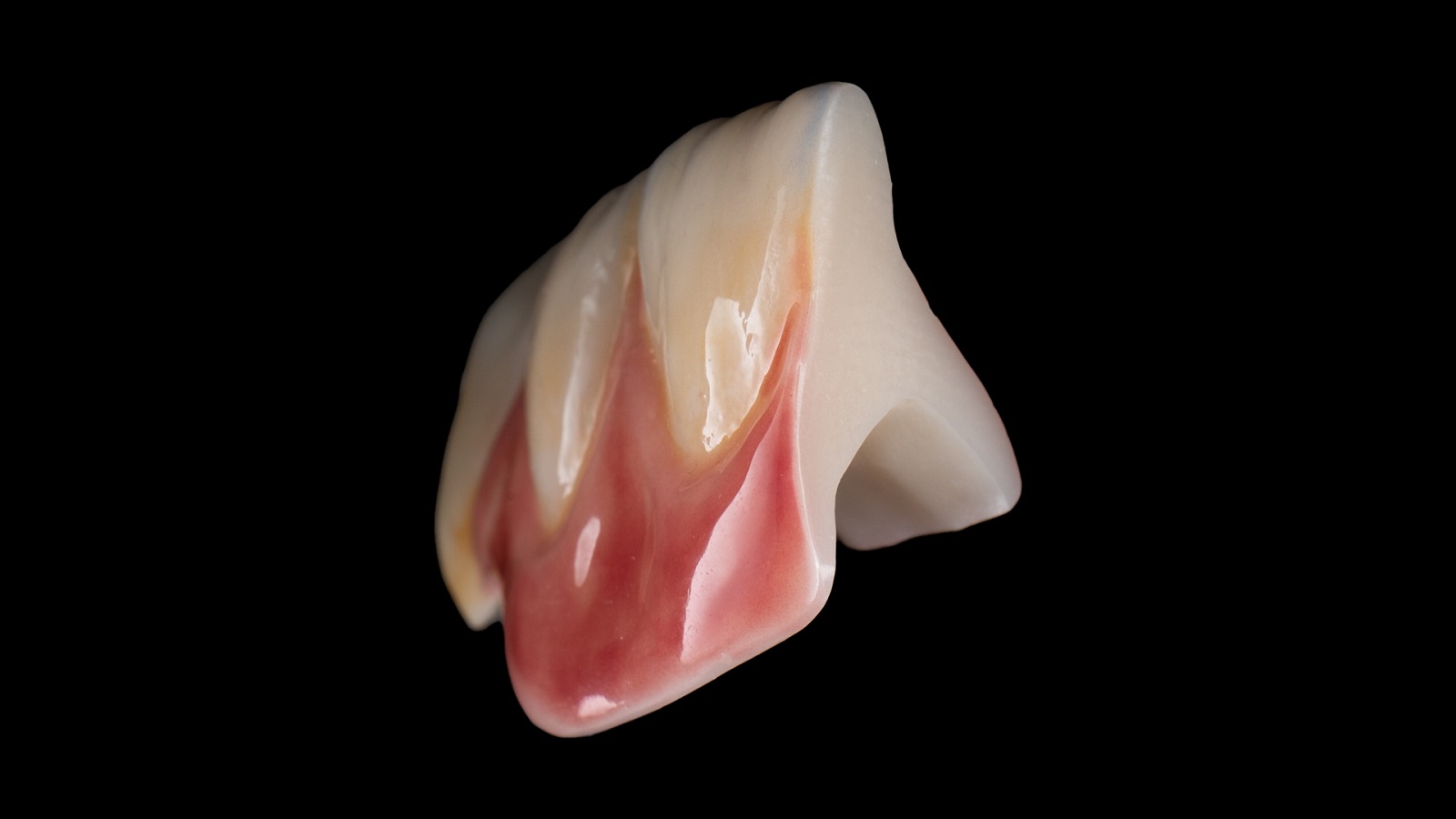 Estética e acabamento naturais, mesmo em camadas extremamente finas.