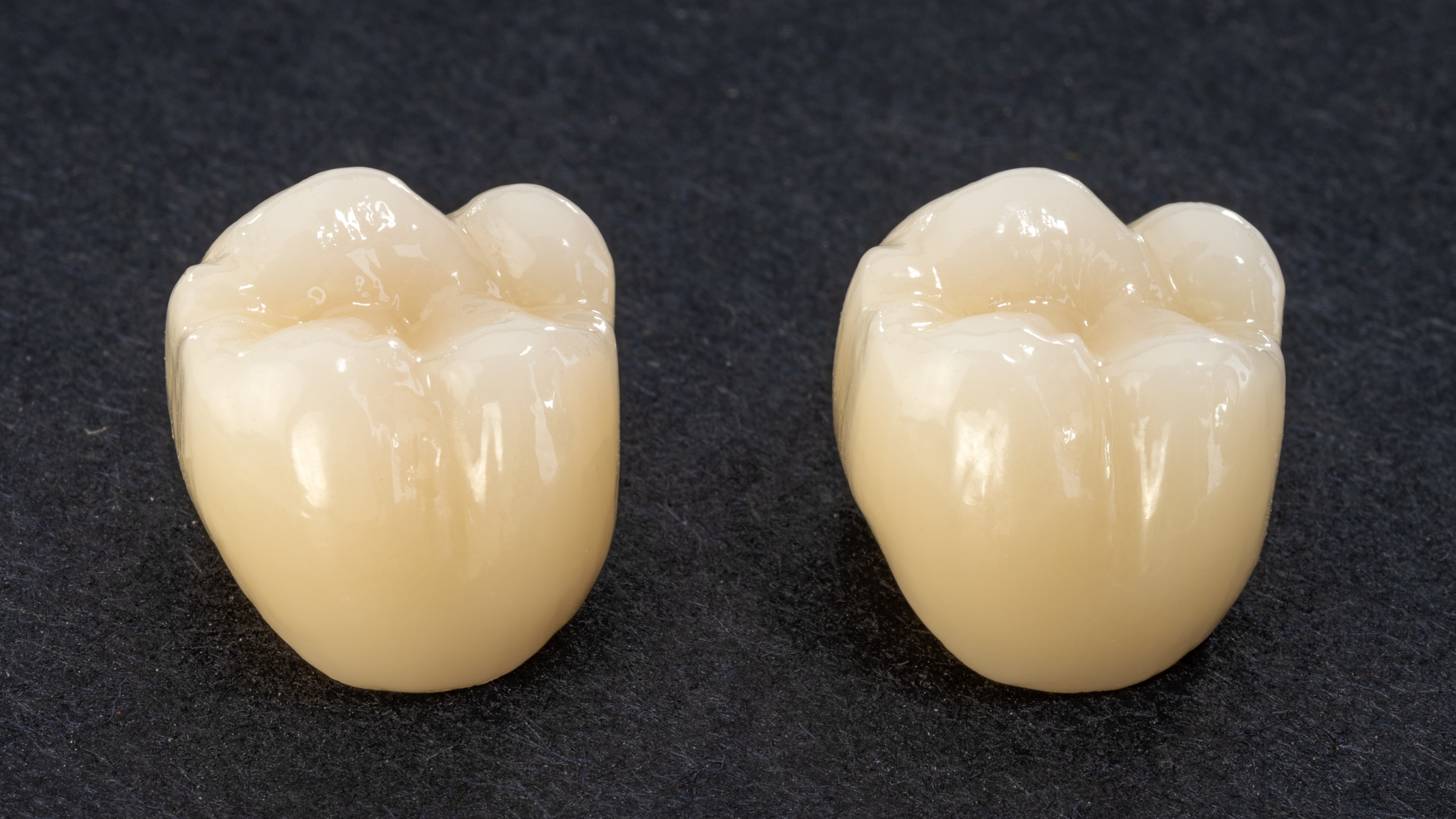 Crowns in normal light conditions